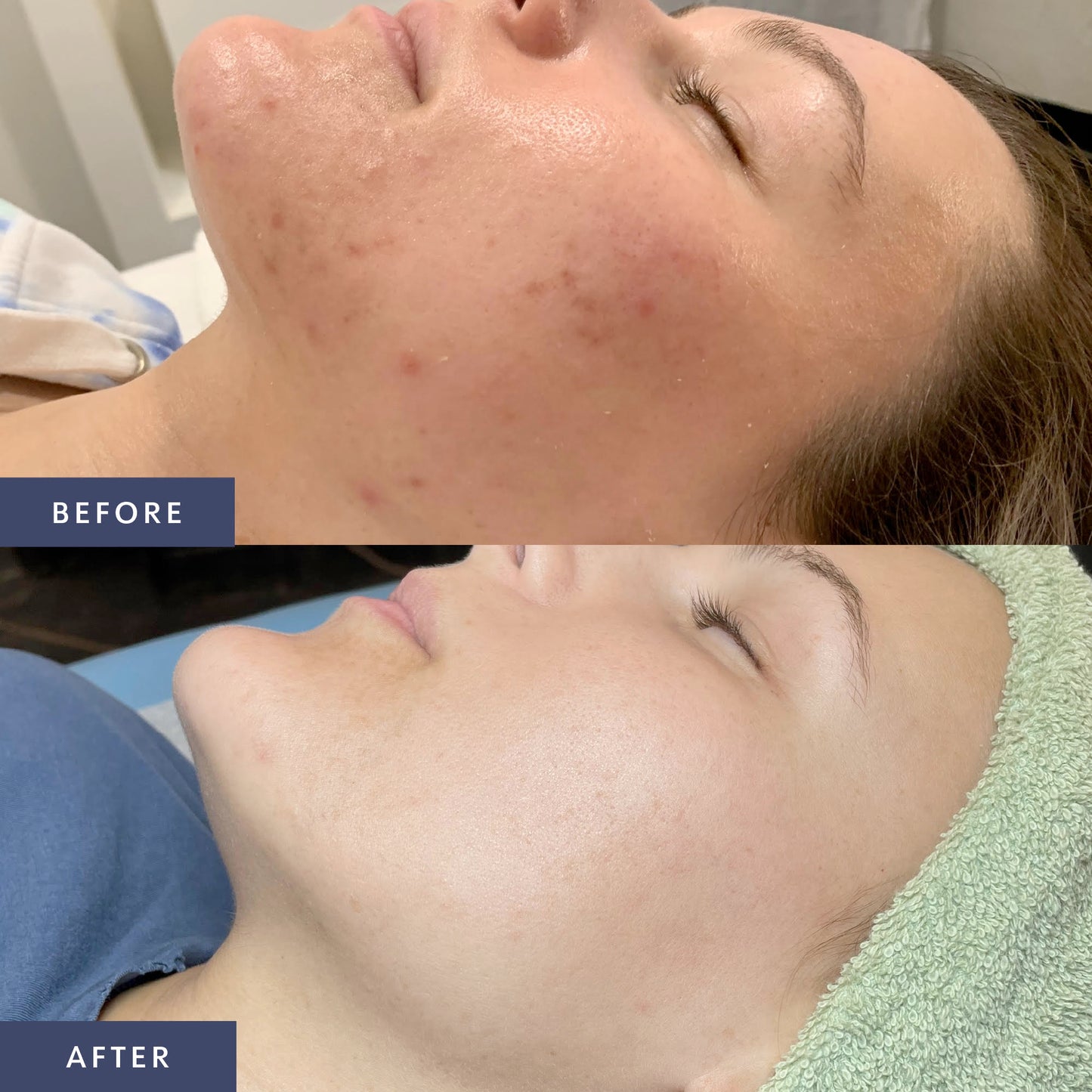 Mikura Clear Skin Membership